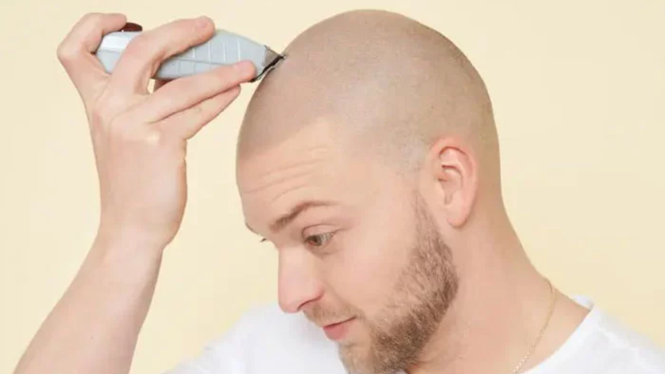 The Benefits of Scalp Micropigmentation for Thinning Hair
