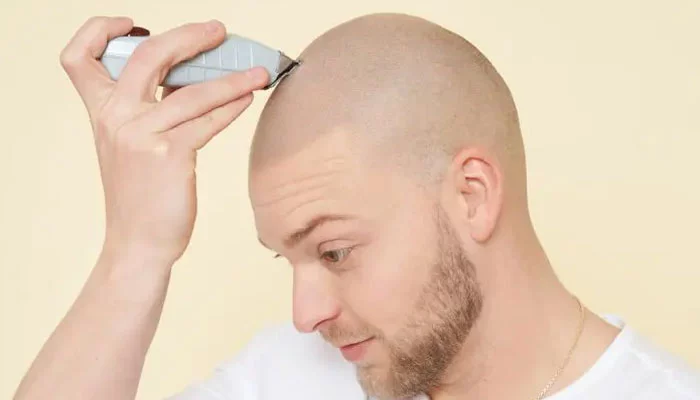 The Benefits of Scalp Micropigmentation for Thinning Hair