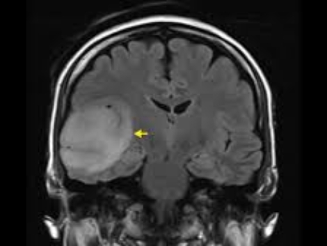 Neuroradiology's Role in Understanding Brain Connectivity