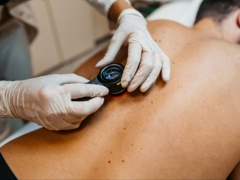 How Dermatologists Identify Early Symptoms of Skin Cancer