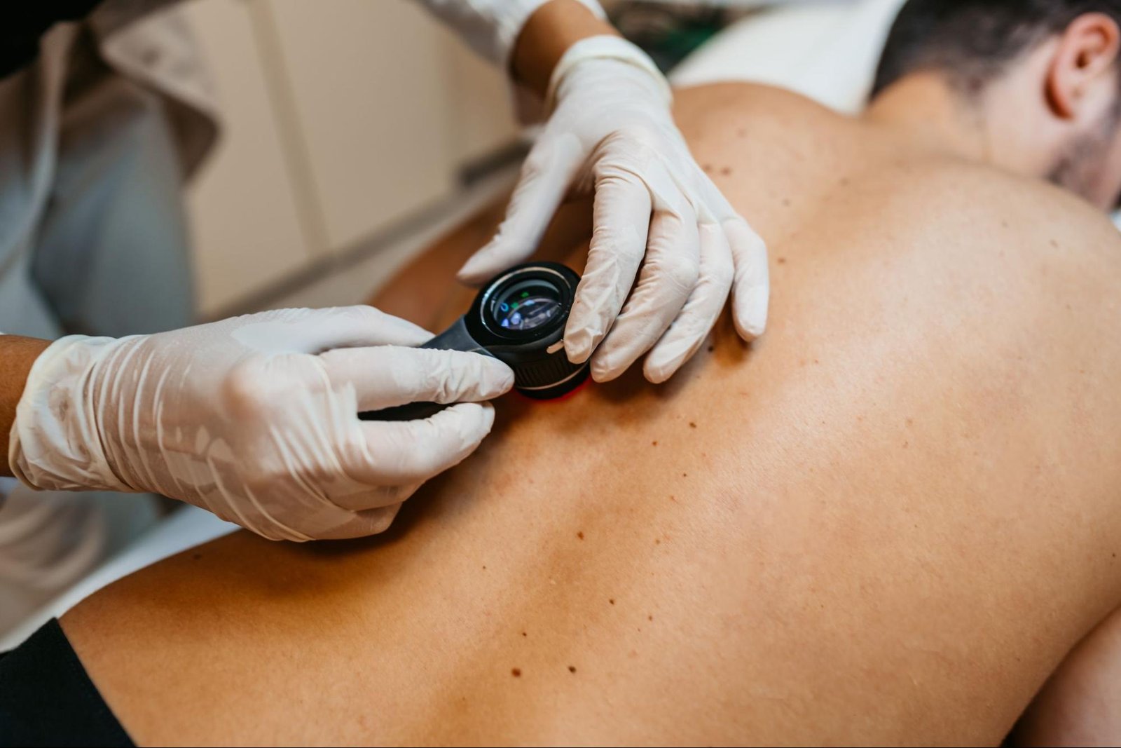 How Dermatologists Identify Early Symptoms of Skin Cancer